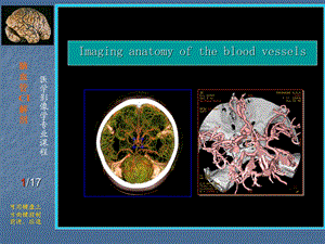 脑血管CT解剖PPT课件.ppt