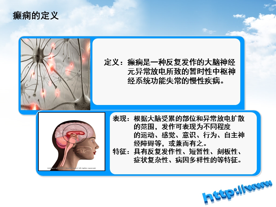 癫痫的急救和护理.ppt_第3页