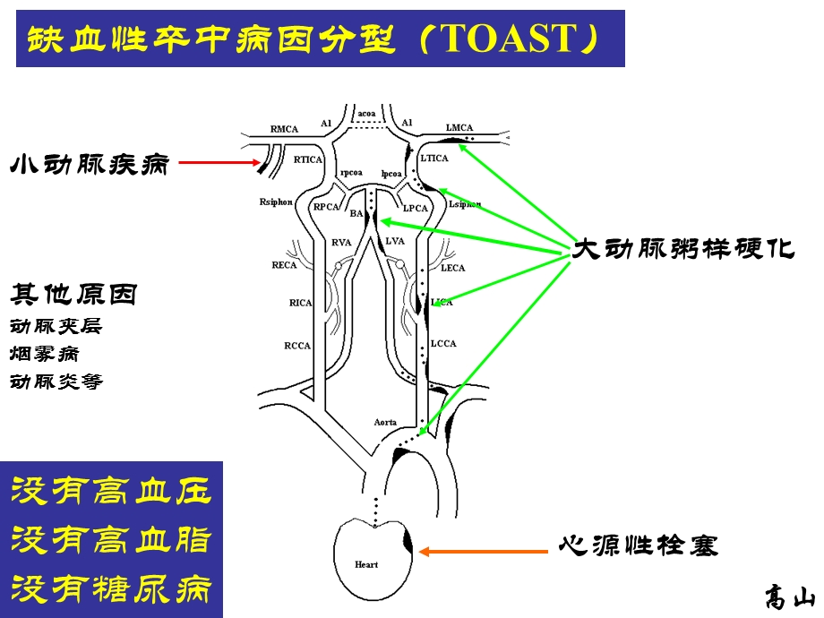 缺血性卒中诊治三重奏.ppt_第3页