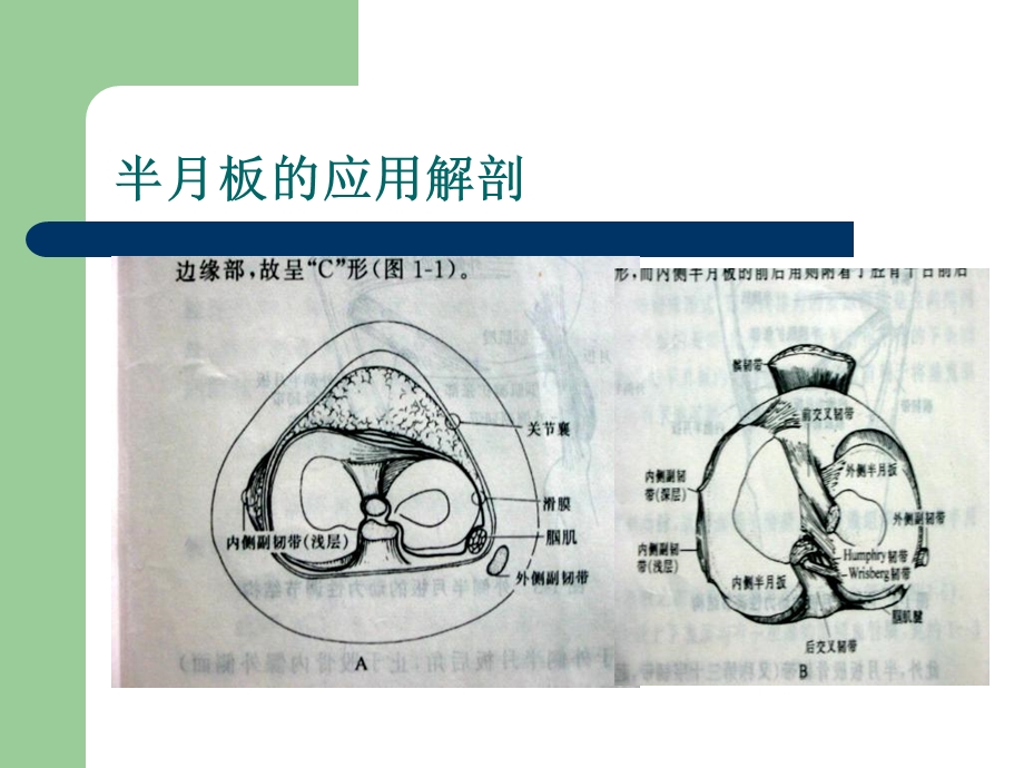 半月板的解剖与功能.ppt_第3页