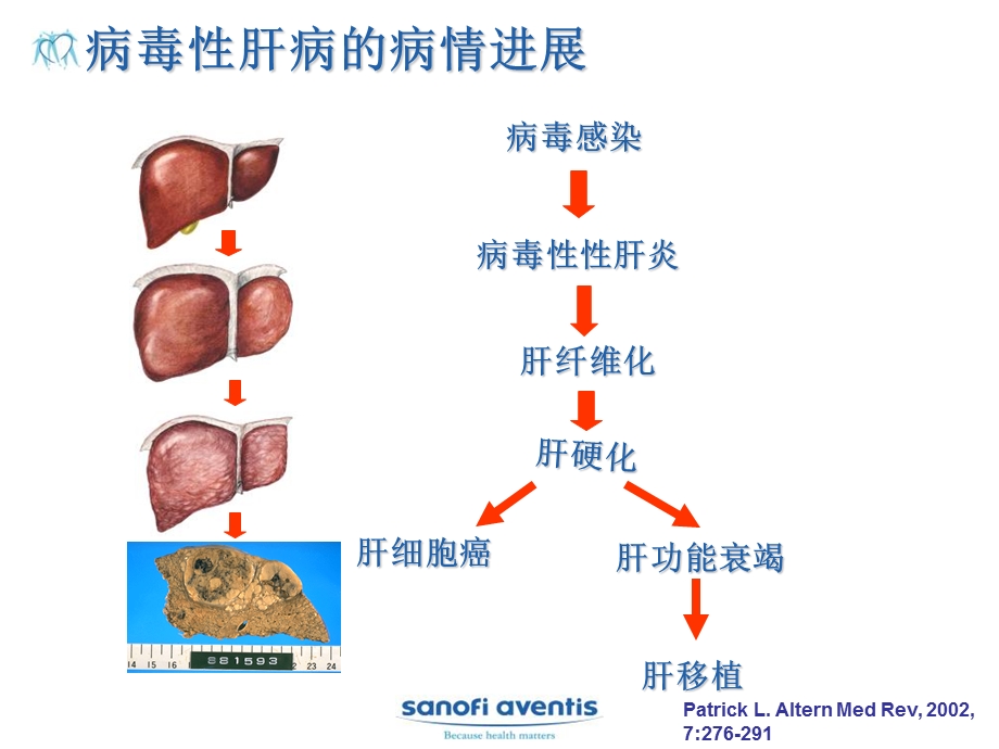 病毒性肝病与膜保护.ppt_第3页