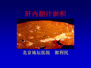 肝内胆汁淤积-武汉.ppt