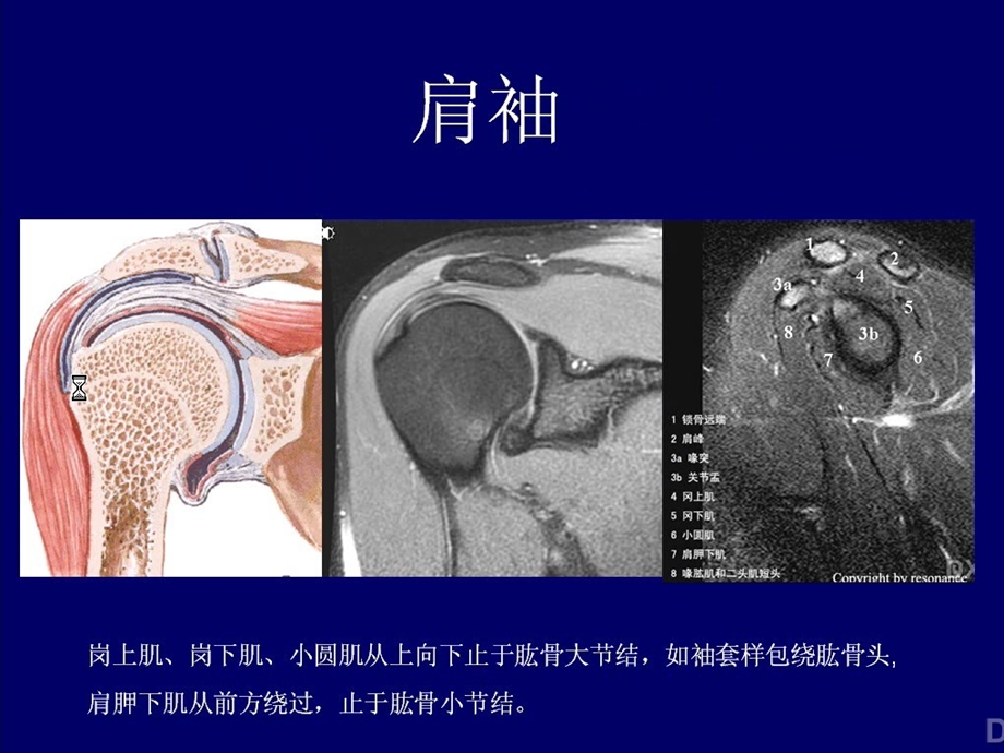 肩关节MRI影像诊断.ppt_第3页