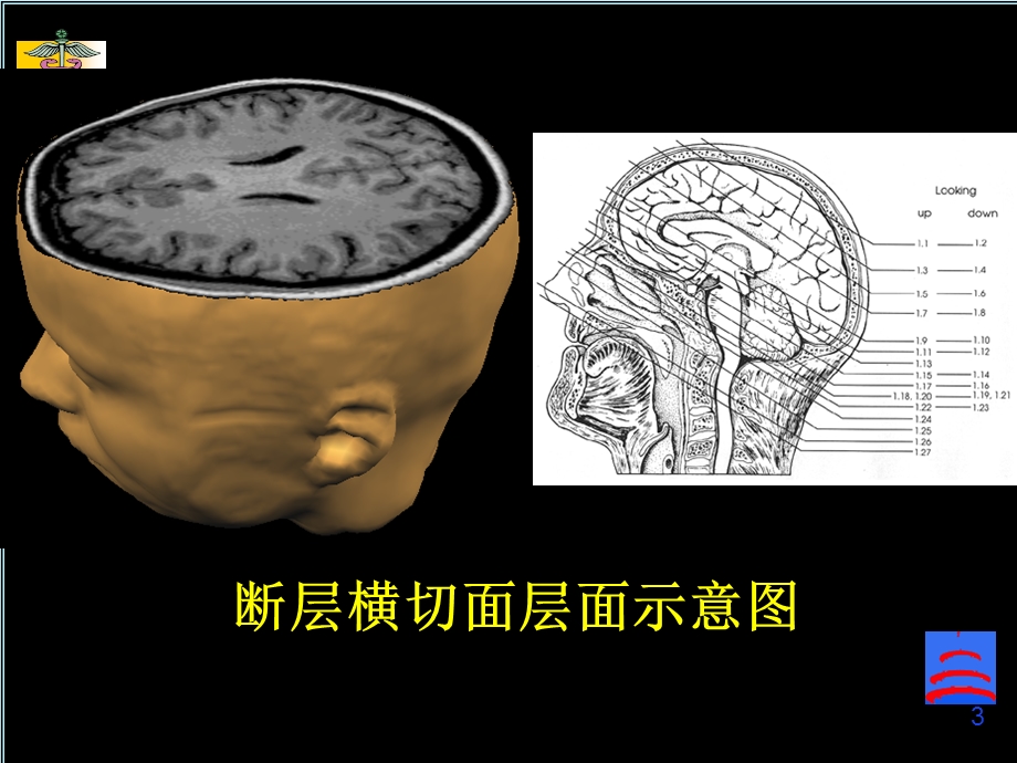 脑磁共振局部解剖与功能图谱PPT课件.ppt_第3页