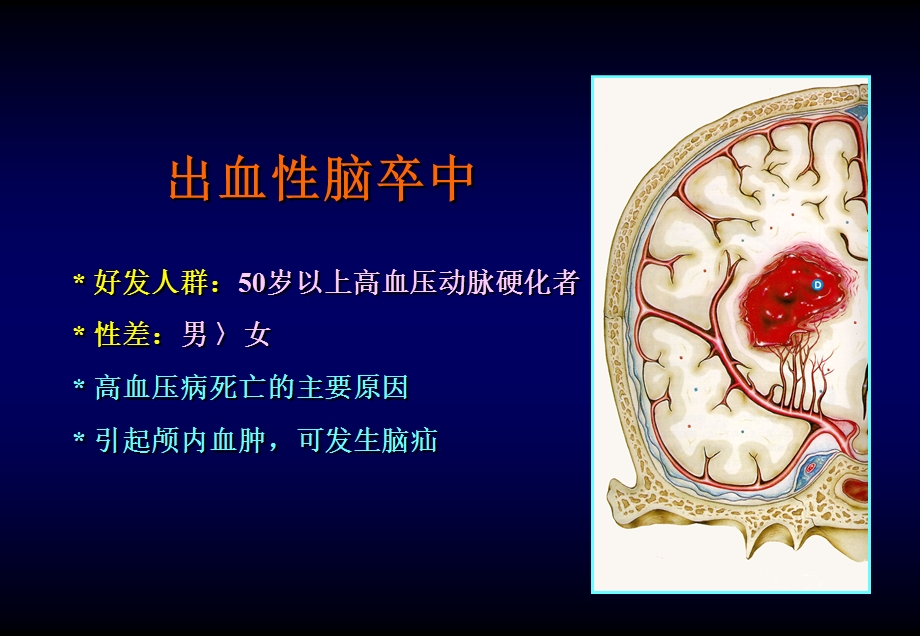 脑卒中的外科治疗神经外科教学课件.ppt_第2页