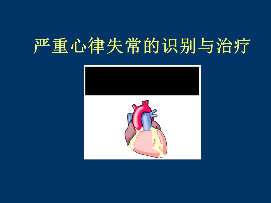 常见心律失常诊断治疗.ppt_第1页