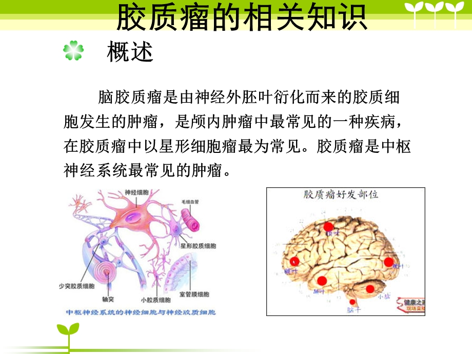 胶质瘤患者的术后护理.ppt_第3页