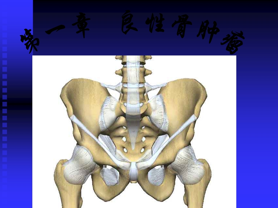 骨肿瘤X线病历图谱骨瘤【课件PPT】.ppt_第2页