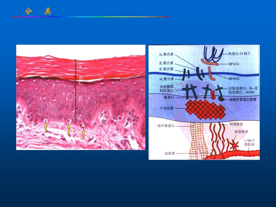 课件-大疱性皮肤病.ppt_第3页