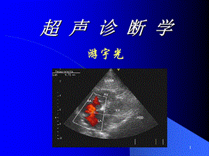 超声诊断学-02基础和原理游宇光.ppt