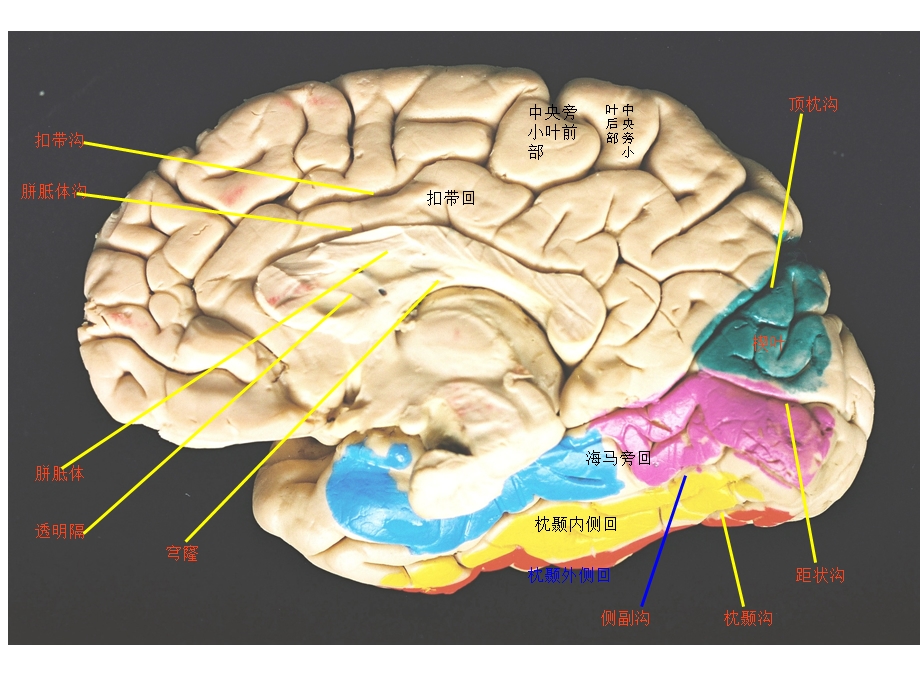 颅脑断层解剖.ppt_第3页