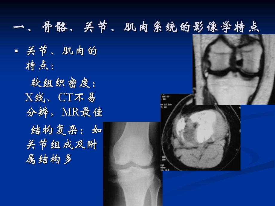 骨关节、肌肉系统影像学诊断.ppt_第3页