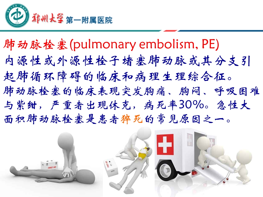 腔静脉滤器的选择介绍.ppt_第3页