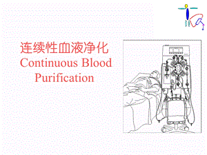 连续性血液滤过详解.ppt