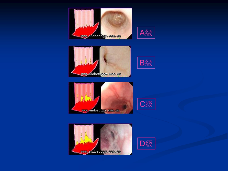 上消化道内镜诊断规范PPT课件.ppt_第2页