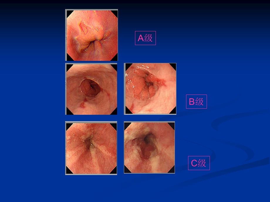上消化道内镜诊断规范PPT课件.ppt_第3页