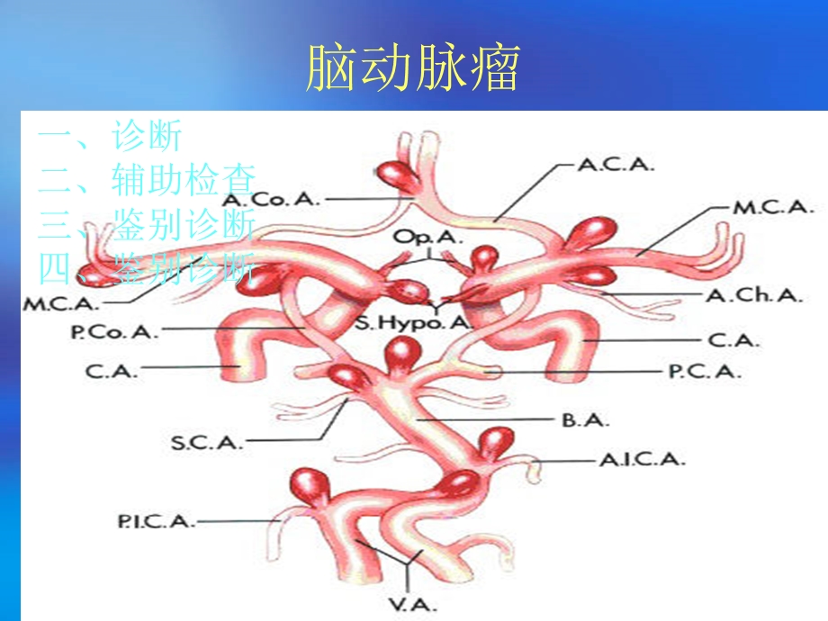 脑动脉瘤鉴别诊断.ppt_第2页