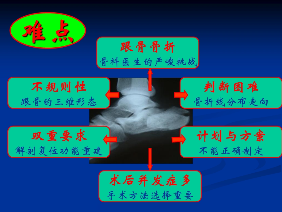 跟骨骨折治疗的新理念.ppt_第2页