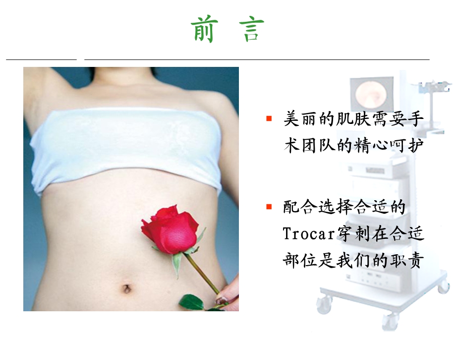 腹腔镜手术穿刺孔位.ppt_第2页