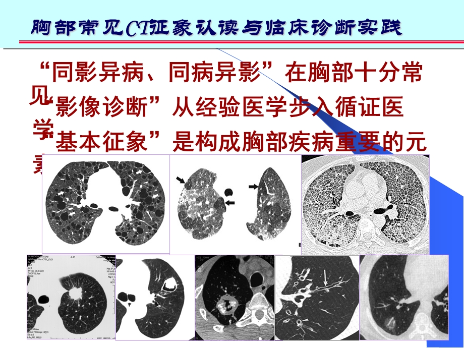 肺部CT十大征象诊断.ppt_第2页