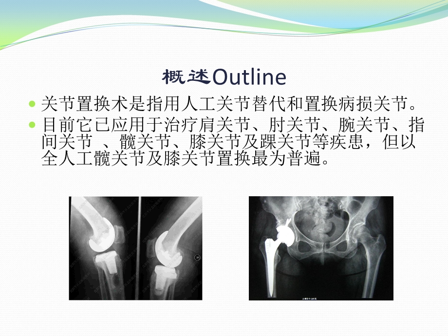 康复医学教学课件 关节置换术后的康复.ppt_第2页