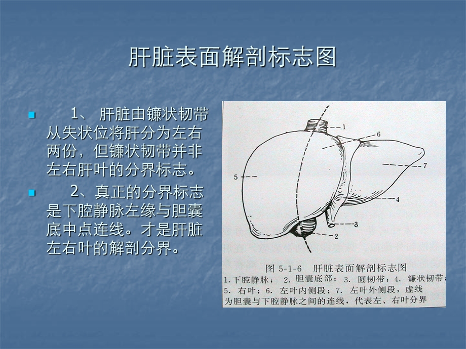 腹部CT影像断层解剖.ppt_第3页