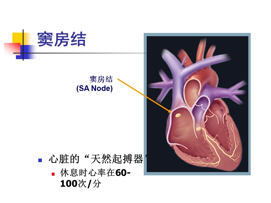 起搏适应证.ppt_第3页