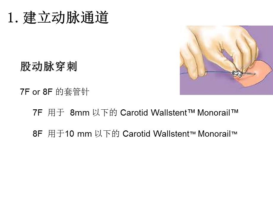 颈动脉支架手术步.ppt_第3页