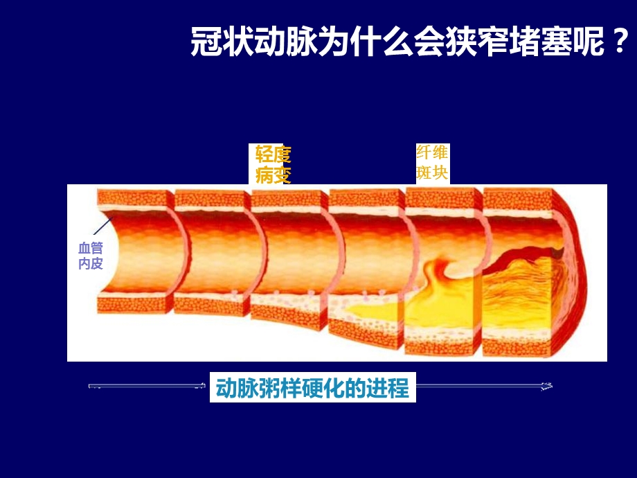 调脂治疗的目标与现状.ppt_第2页