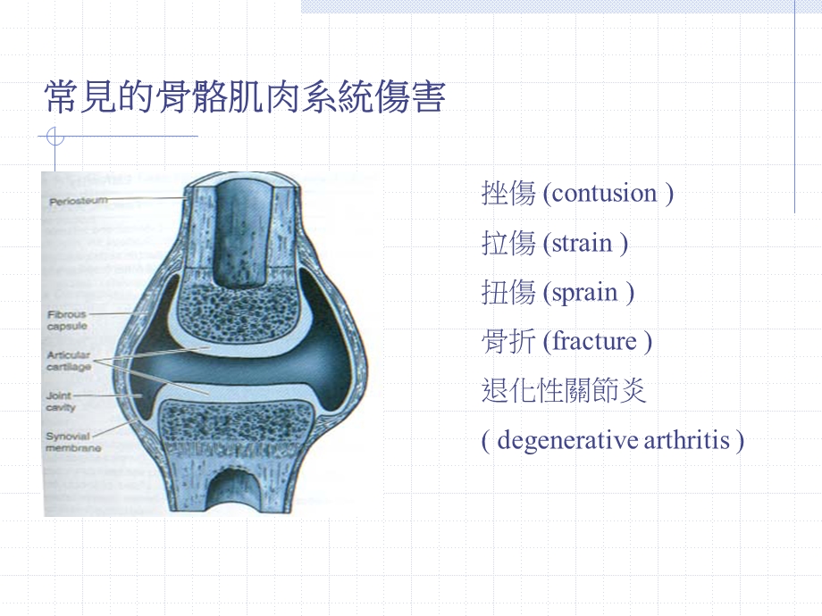 关部分保护与关部分炎的预防.ppt_第2页