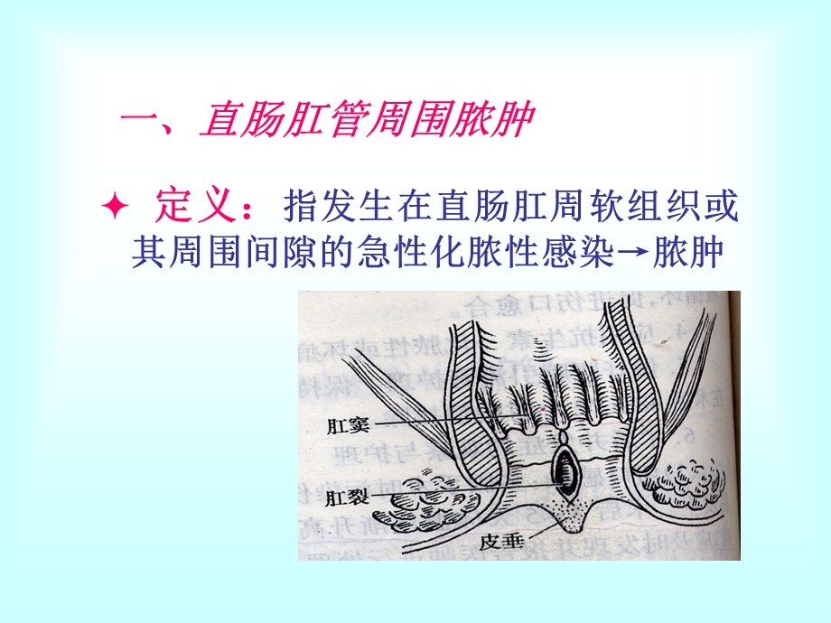 大肠肛管疾病护理.ppt_第3页