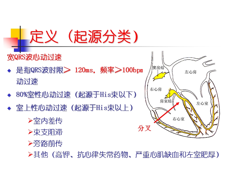 复杂宽QRS心动过速解析.ppt_第2页