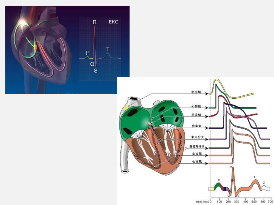 心脏内科 .3心律失常.ppt_第3页