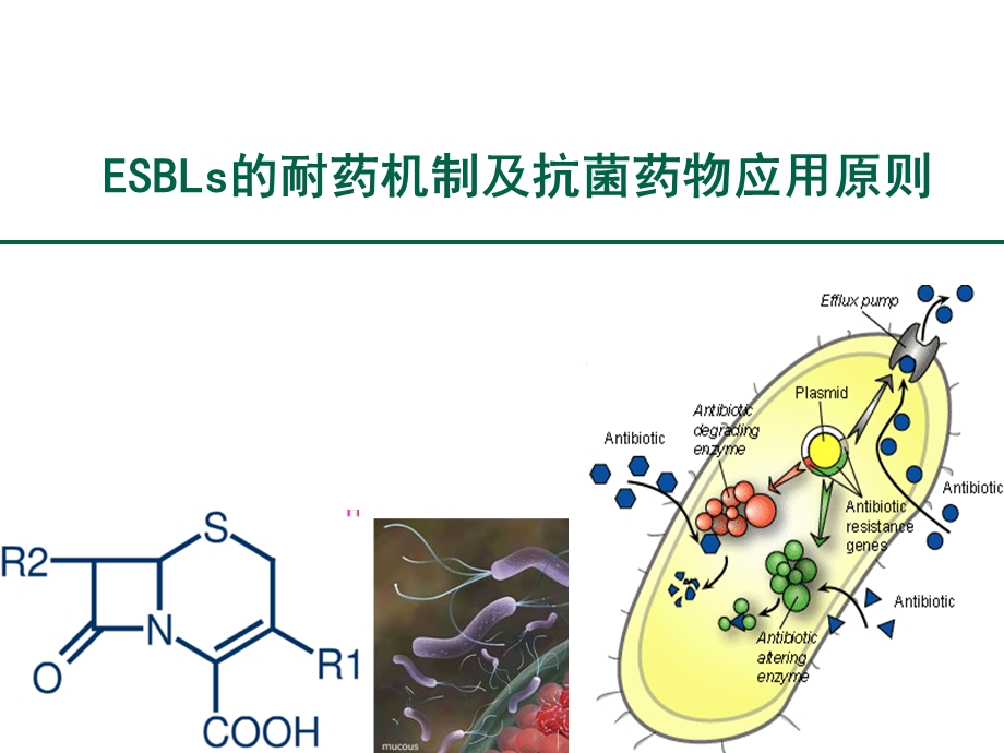 esbls的耐药机制及抗菌药物应用原则.ppt_第1页