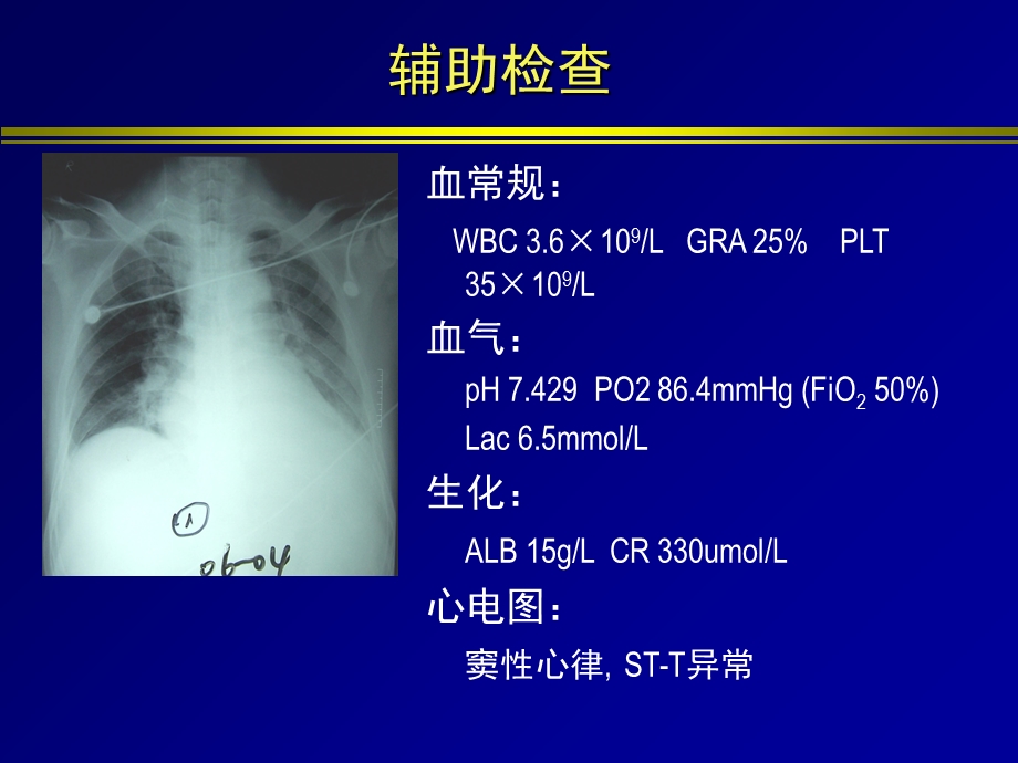 CCO技术在ARDS诊断和治疗中的应用.ppt_第3页