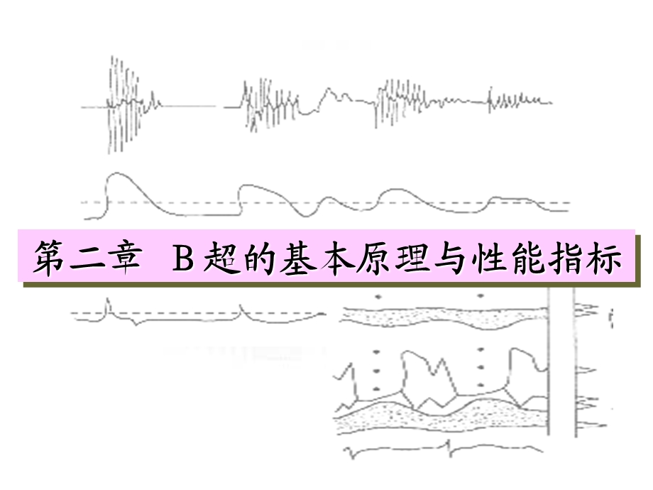 B超的基本原理与性能指标.ppt_第1页