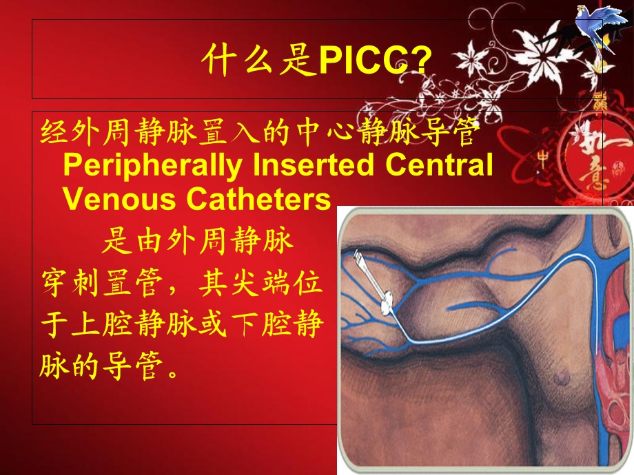 ICC常见并发症及处理护理查房.ppt_第3页