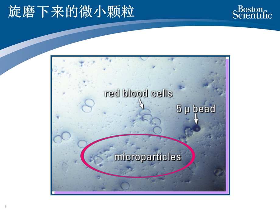 Rotablator旋磨原理和护理.ppt_第3页