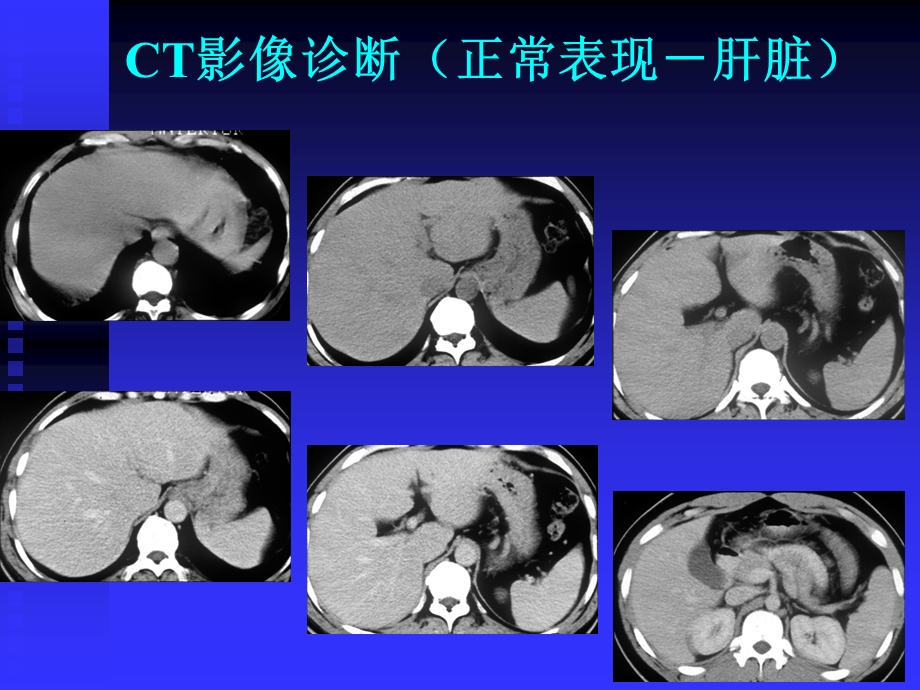 临床执业医师考试大纲(医学影像学CT.ppt_第2页