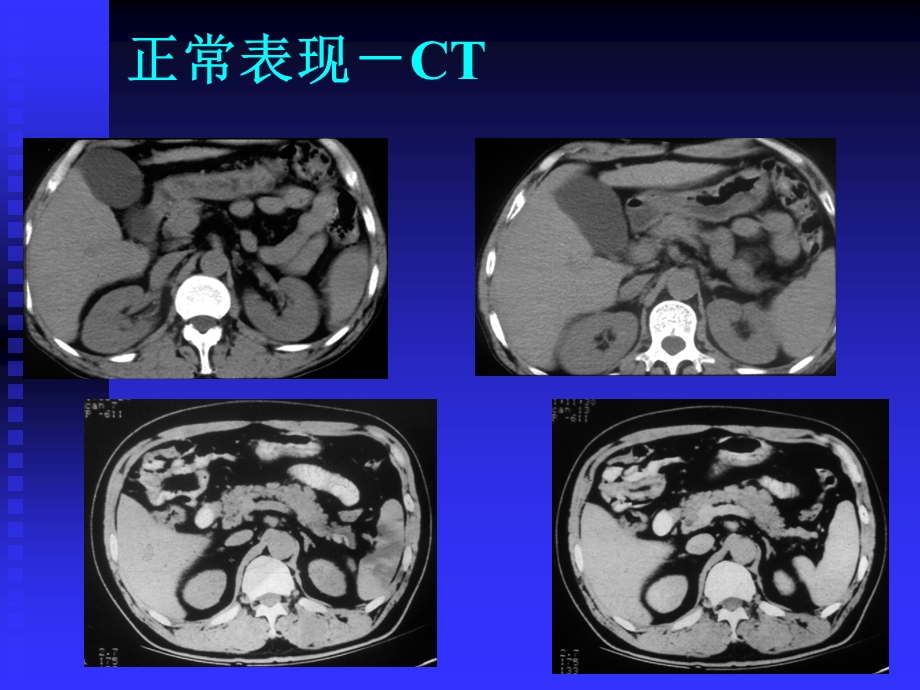 临床执业医师考试大纲(医学影像学CT.ppt_第3页