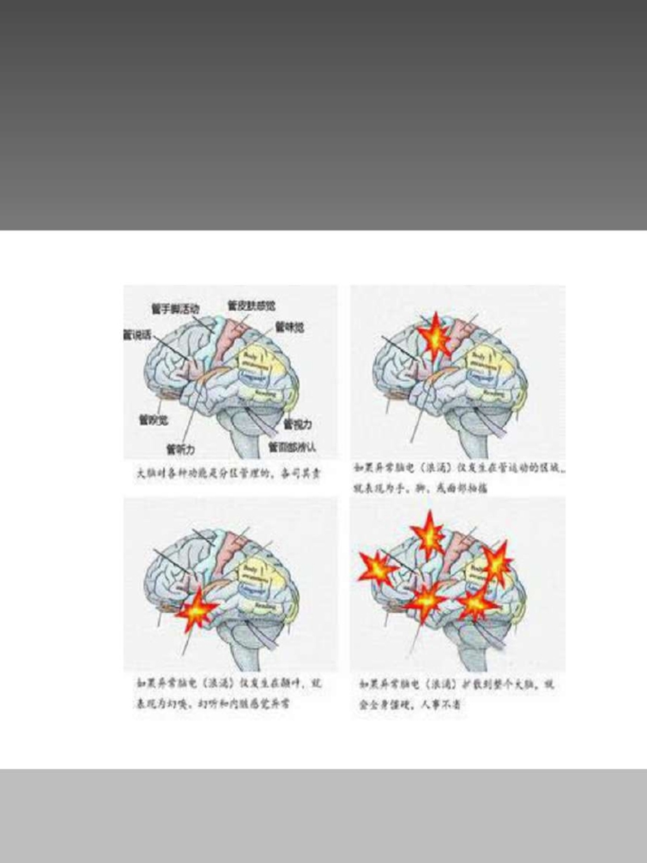 内科护理学课件-癫痫.pptx_第3页