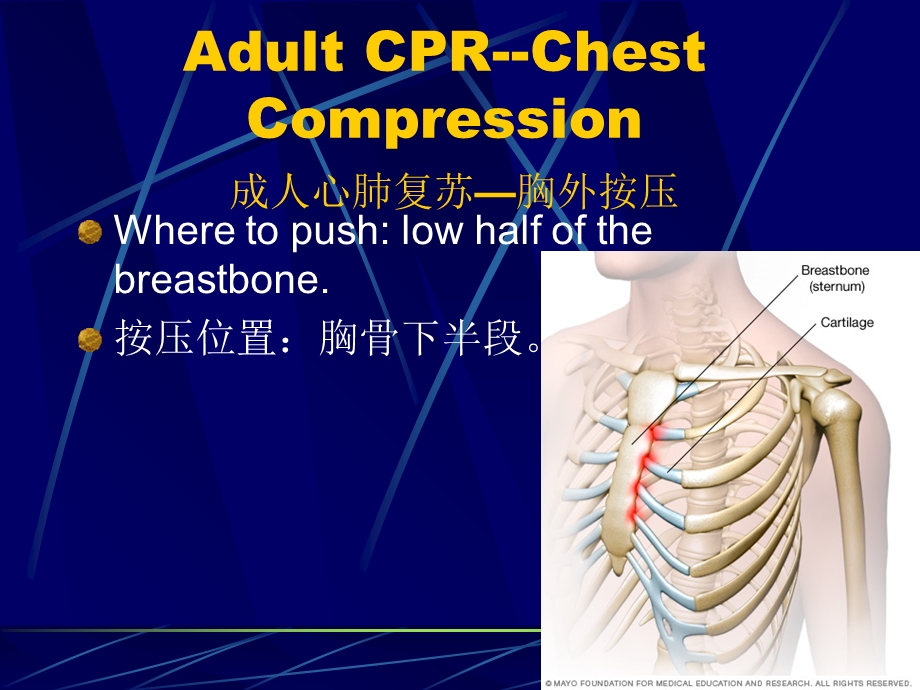 心肺复苏及基础急救培训讲义.ppt_第3页