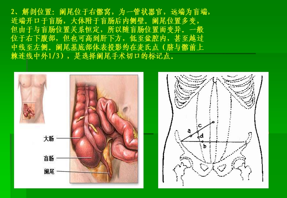 阑尾炎超声诊断王建军.ppt_第3页