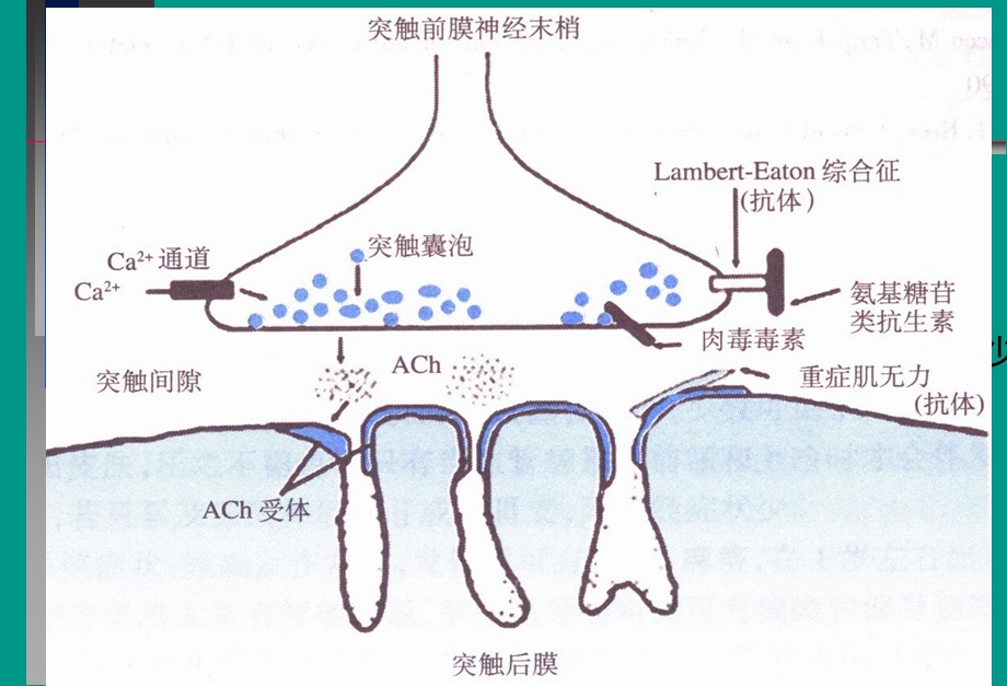 神经病学教学课件-重症肌无力中文.ppt_第3页