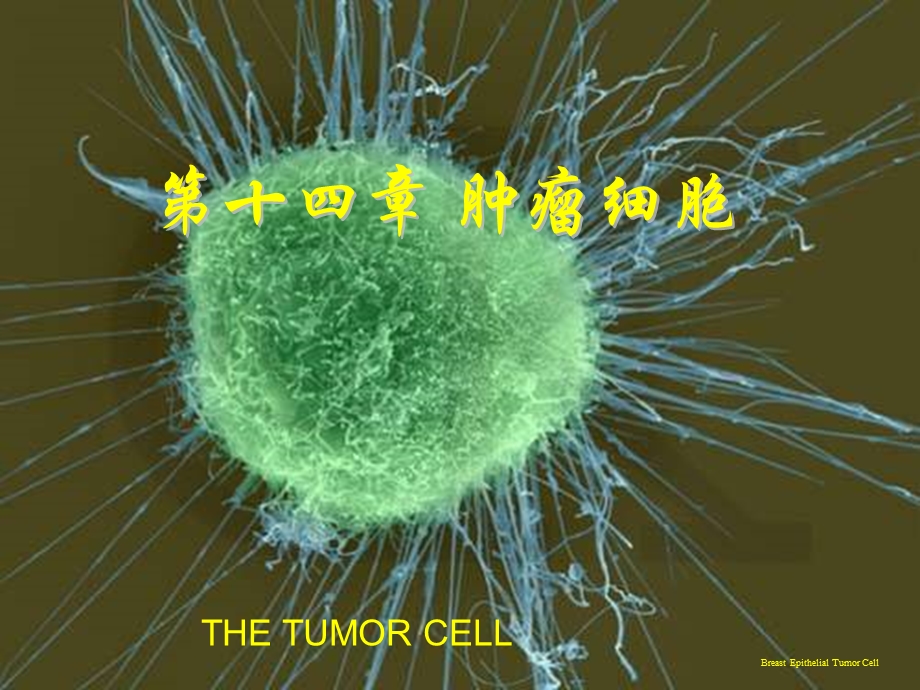 细胞生物学教程第十四章肿瘤细胞.ppt_第1页