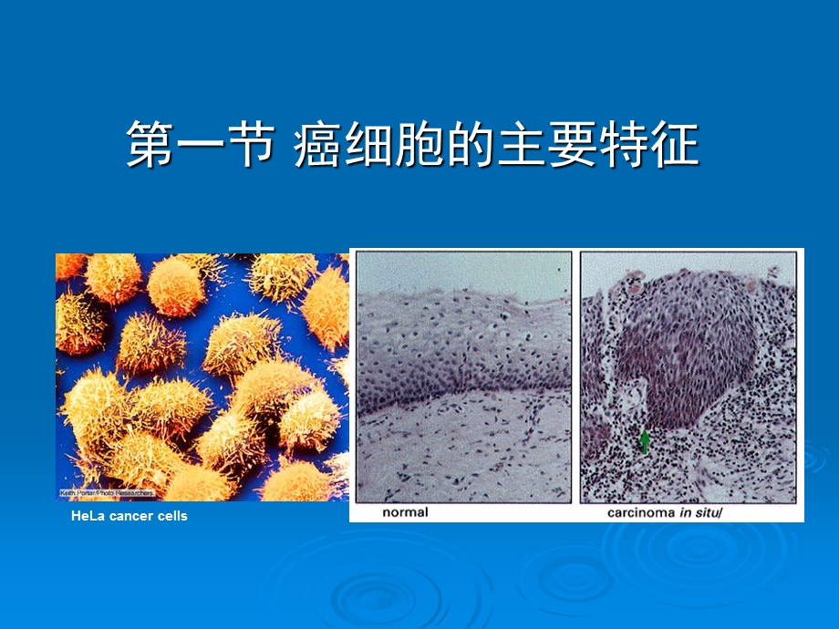 细胞生物学教程第十四章肿瘤细胞.ppt_第3页