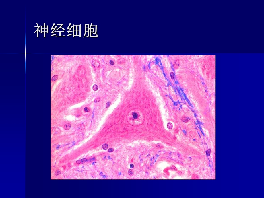 神经系统疾病-带.ppt_第2页