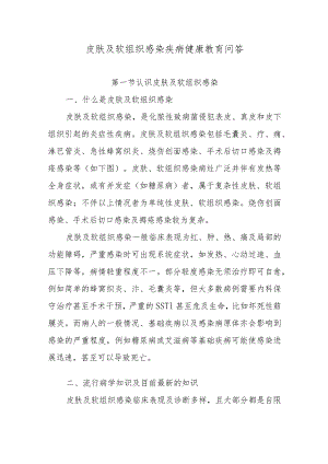 皮肤及软组织感染疾病健康教育问答.docx