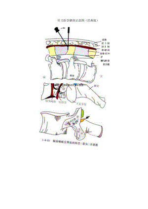 针刀医学《针刀入路示意图》.docx