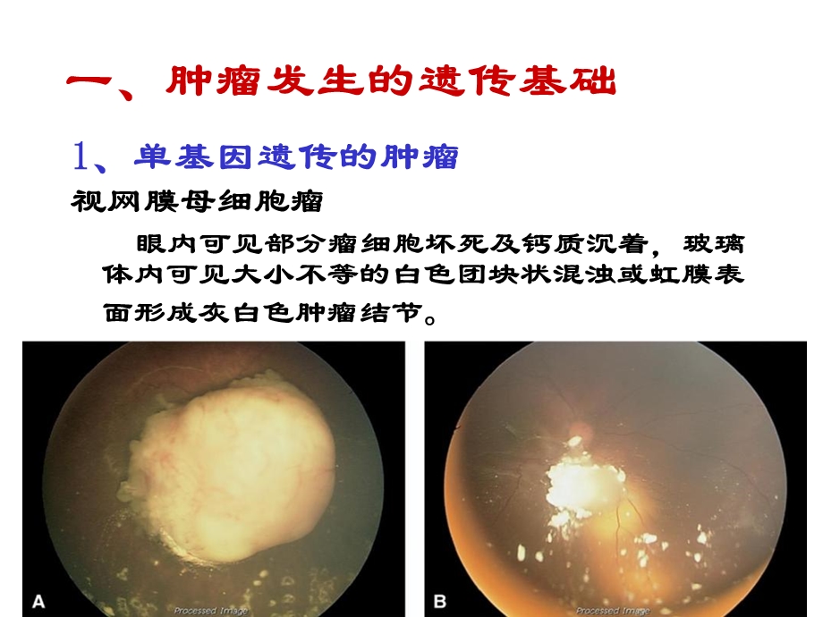 肿瘤遗传学cancergenetics肿瘤发生的遗传基础.ppt_第2页